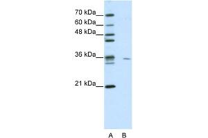 WB Suggested Anti-MDS032 Antibody Titration:  0. (Use1 Antikörper  (N-Term))