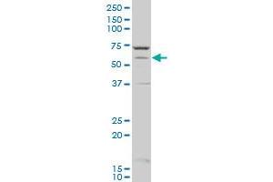 CYP1A2 polyclonal antibody (A01), Lot # 051122JC01 Western Blot analysis of CYP1A2 expression in A-431 . (CYP1A2 Antikörper  (AA 211-310))