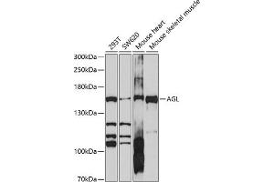Western blot analysis of extracts of various cell lines, using AGL antibody (ABIN6131508, ABIN6136632, ABIN6136633 and ABIN6214165) at 1:1000 dilution. (AGL Antikörper  (AA 1233-1532))