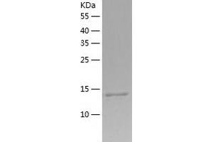Western Blotting (WB) image for Inhibitor of DNA Binding 1, Dominant Negative Helix-Loop-Helix Protein (ID1) (AA 1-155) protein (His tag) (ABIN7123426) (ID1 Protein (AA 1-155) (His tag))