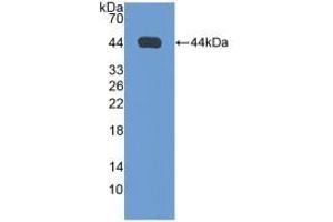 Figure. (NPPA Antikörper  (AA 25-152))