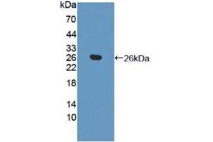 Figure. (TAGLN2 Antikörper  (AA 2-199))