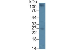 Detection of CEBPd in Mouse Spleen lysate using Polyclonal Antibody to CCAAT/Enhancer Binding Protein Delta (CEBPd) (CEBPD Antikörper  (AA 51-251))