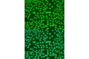 Immunofluorescence analysis of U2OS cells using PSEN2 antibody. (Presenilin 2 Antikörper)