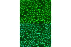 Immunofluorescence analysis of U2OS cells using PSEN2 antibody. (Presenilin 2 Antikörper)
