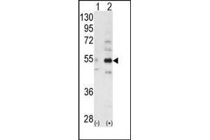 Western blot analysis of ALS2CR2 (arrow) using ALS2CR2 Antibody (STRADB Antikörper  (C-Term))
