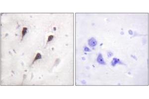 Immunohistochemistry analysis of paraffin-embedded human brain tissue, using WAVE1 (Ab-125) Antibody. (WASF1 Antikörper  (AA 91-140))