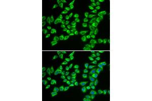 Immunofluorescence analysis of A549 cells using HADHB antibody (ABIN5973344). (HADHB Antikörper)