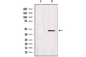 Western blot analysis of extracts from Rat heart, using BBS5 Antibody. (BBS5 Antikörper  (C-Term))