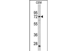 Western blot analysis of CRAT antibody in CEM cell line lysates (35ug/lane)