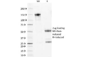SDS-PAGE Analysis Purified Wilm's Tumor Mouse Monoclonal Antibody (6F-H2).