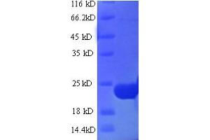 SDS-PAGE (SDS) image for Insulinase Family Metalloproteinase (IDE3) (AA 1-172), (full length) protein (His-SUMO Tag) (ABIN5711091) (IDE3 Protein (AA 1-172, full length) (His-SUMO Tag))