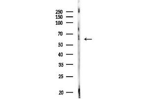 anti-HNF1 Homeobox B (HNF1B) (Internal Region) antibody