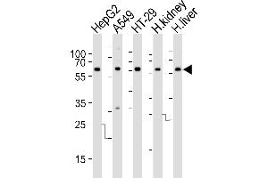 Western blot analysis of lysates from HepG2, A549, HT-29 cell line, human kidney and liver tissue lysate (from left to right), using CYP3A4 Antibody at 1:1000 at each lane. (CYP3A4 Antikörper  (AA 228-255))