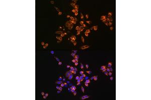 Immunofluorescence analysis of HeLa cells using [KO Validated] Annexin /Annexin V Rabbit pAb (ABIN3022450, ABIN3022451, ABIN3022452 and ABIN1512578) at dilution of 1:100 (40x lens). (Annexin V Antikörper  (AA 1-320))