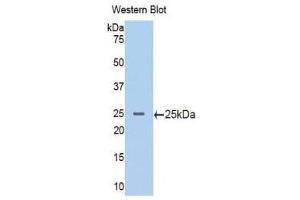 Western Blotting (WB) image for anti-Phosphoinositide-3-Kinase, Catalytic, beta Polypeptide (PIK3CB) (AA 524-703) antibody (ABIN1176787)