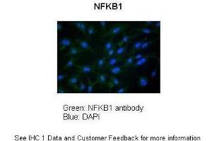 Sample Type :  Chicken DF-1 Firboblast  Primary Antibody Dilution :  1:100  Secondary Antibody :  Anti-rabbit FITC  Secondary Antibody Dilution :  1:300  Color/Signal Descriptions :  NFKB1: Green DAPI:Blue  Gene Name :  NFKB1   Submitted by :  Anonymous (NFKB1 Antikörper  (N-Term))