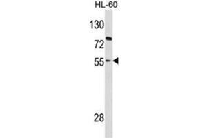 Western blot analysis of PAX8 Antibody (Center) in HL-60 cell line lysates (35ug/lane). (PAX8 Antikörper  (Middle Region))