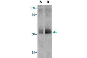 Western blot analysis of SPRED2 in human small intestine tissue lysate with SPRED2 polyclonal antibody  at (A) 1 and (B) 2 ug/mL .