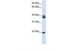 Image no. 1 for anti-Synaptophysin (SYP) (N-Term) antibody (ABIN6738166) (Synaptophysin Antikörper  (N-Term))