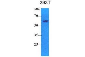 Western Blotting (WB) image for anti-Pyruvate Kinase, Liver and RBC (PKLR) antibody (ABIN781545) (PKLR Antikörper)