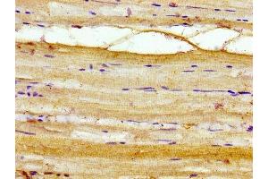 Immunohistochemistry of paraffin-embedded human skeletal muscle tissue using ABIN7142919 at dilution of 1:100 (AKIP1 Antikörper  (AA 57-167))