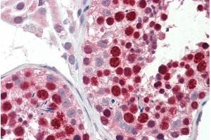 ABIN263230 (5µg/ml) staining of paraffin embedded Human Testis. (ABCA9 Antikörper  (Internal Region))