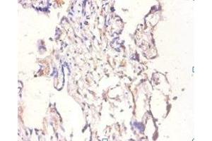 Immunohistochemistry of paraffin-embedded human placenta tissue using ABIN7145696 at dilution of 1:100 (BMP6 Antikörper  (AA 382-513))