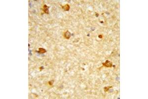 Formalin-fixed and paraffin-embedded human brain tissue reacted with DIRAS1 Antibody , which was peroxidase-conjugated to the secondary antibody, followed by DAB staining. (DIRAS1 Antikörper  (Middle Region))