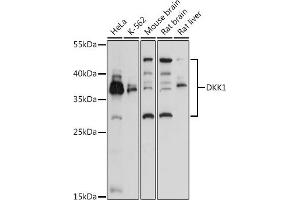 Western blot analysis of extracts of various cell lines, using DKK1 antibody (ABIN3016252, ABIN3016253, ABIN3016254 and ABIN6219665) at 1:3000 dilution. (DKK1 Antikörper  (AA 71-266))