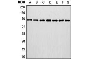 Western blot analysis of Involucrin expression in MCF7 (A), A375 (B), A431 (C), NIH3T3 (D), HT1080 (E), mouse brain (F), rat brain (G) whole cell lysates. (Involucrin Antikörper  (C-Term))