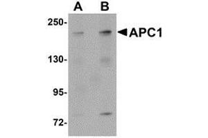 Western blot analysis of APC1 in SK-N-SH cell lysate with AP30057PU-N APC1 antibody at (A) 1 and (B) 2 μg/ml.