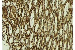 ABIN6272547 at 1/100 staining Mouse kidney tissue by IHC-P.