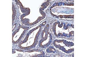 IHC analysis of Kindlin 2/FERMT2 using anti-Kindlin 2/FERMT2 antibody (ABIN7599515). (FERMT2 Antikörper  (AA 1-650))