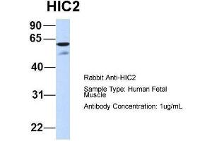 Host:  Rabbit  Target Name:  HIC2  Sample Type:  Human Fetal Muscle  Antibody Dilution:  1.