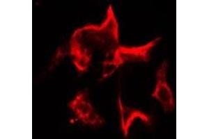 ABIN6277269 staining Hela cells by IF/ICC. (FLIP Antikörper  (Internal Region))
