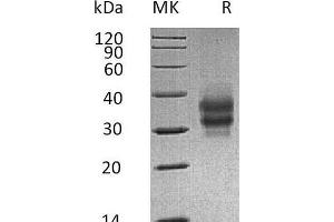 Western Blotting (WB) image for Folate Receptor 1 (Adult) (FOLR1) (AA 25-232) protein (His tag) (ABIN7320833)