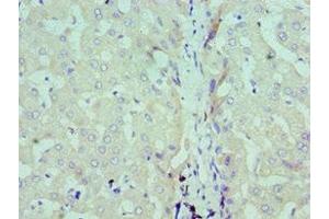 Immunohistochemistry of paraffin-embedded human liver tissue using ABIN7171193 at dilution of 1:100 (Syndecan 1 Antikörper  (AA 25-240))