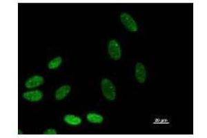 Immunostaining analysis in HeLa cells. (BAZ1B Antikörper)