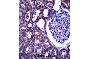 NPC1 Antibody (Center) (ABIN657395 and ABIN2846435) immunohistochemistry analysis in formalin fixed and paraffin embedded human kidney tissue followed by peroxidase conjugation of the secondary antibody and DAB staining. (NPC1 Antikörper  (AA 591-620))