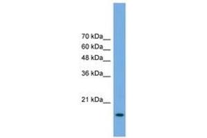 Image no. 1 for anti-Processing of Precursor 5, Ribonuclease P/MRP Subunit (POP5) (AA 71-120) antibody (ABIN6746471) (POP5 Antikörper  (AA 71-120))