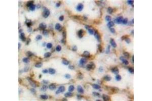 Immunohistochemistry (IHC) image for anti-Tumor Necrosis Factor (Ligand) Superfamily, Member 8 (TNFSF8) (AA 60-227) antibody (ABIN7431083)