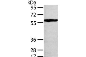 Western Blot analysis of 293T cell using THAP4 Polyclonal Antibody at dilution of 1/250 (THAP4 Antikörper)