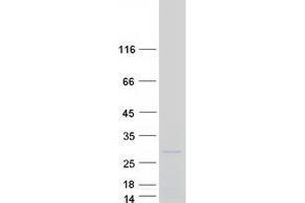 VAX1 Protein (Transcript Variant 2) (Myc-DYKDDDDK Tag)