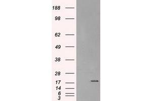 Image no. 2 for anti-Crystallin, alpha B (CRYAB) antibody (ABIN1497648) (CRYAB Antikörper)