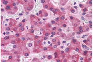 Human Liver: Formalin-Fixed, Paraffin-Embedded (FFPE) (SIPA1L2 Antikörper  (N-Term))