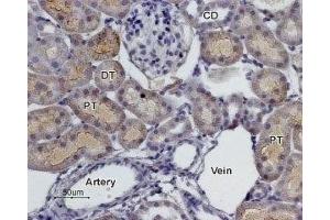 Immunohistochemistry (IHC) image for anti-Adrenergic, alpha-2C-, Receptor (ADRA2C) (AA 192-207), (C202S), (Extracellular) antibody (ABIN7042901)