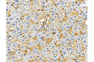 anti-Osteocrin (OSTN) antibody