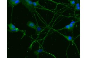 Immunofluorescent staining of differentiated SH-SY5Y cells (TRKB Antikörper  (AA 156-322))