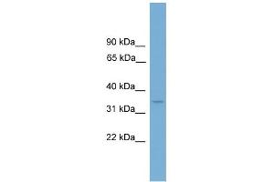 WB Suggested Anti-LUM Antibody Titration: 0. (LUM Antikörper  (Middle Region))